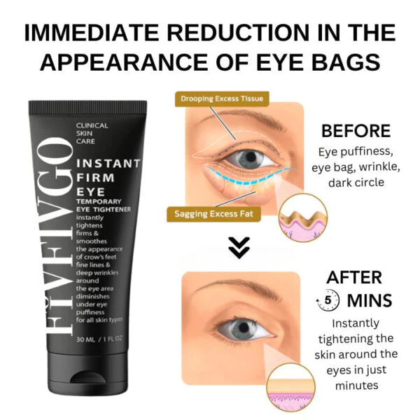 Fivfivgo™ Instant Eye Tightener